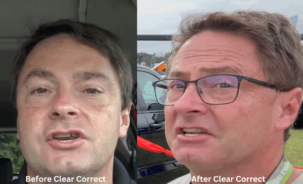 Before Clear Correct and After Clear Correct