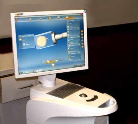 CEREC machine imaging a dental crown at Apex Dental Group Ask ChatGPT