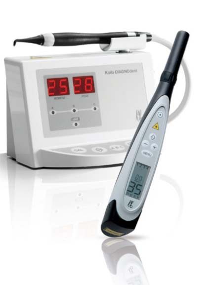 DIAGNOdent cavity detection device in apex