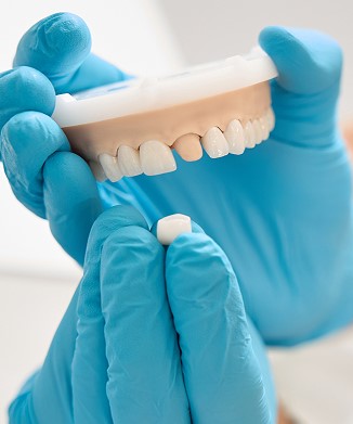 cerec-same-day-crowns